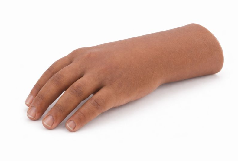 Prosthetic Hand From DIMA