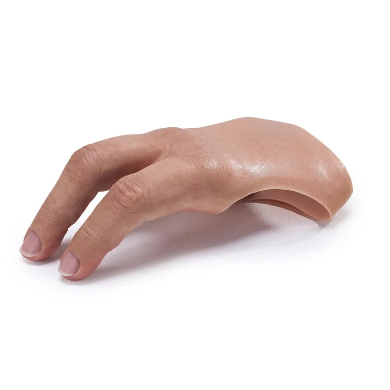 Prosthetic Partial Hand From DIMA - Index and Middle fingers