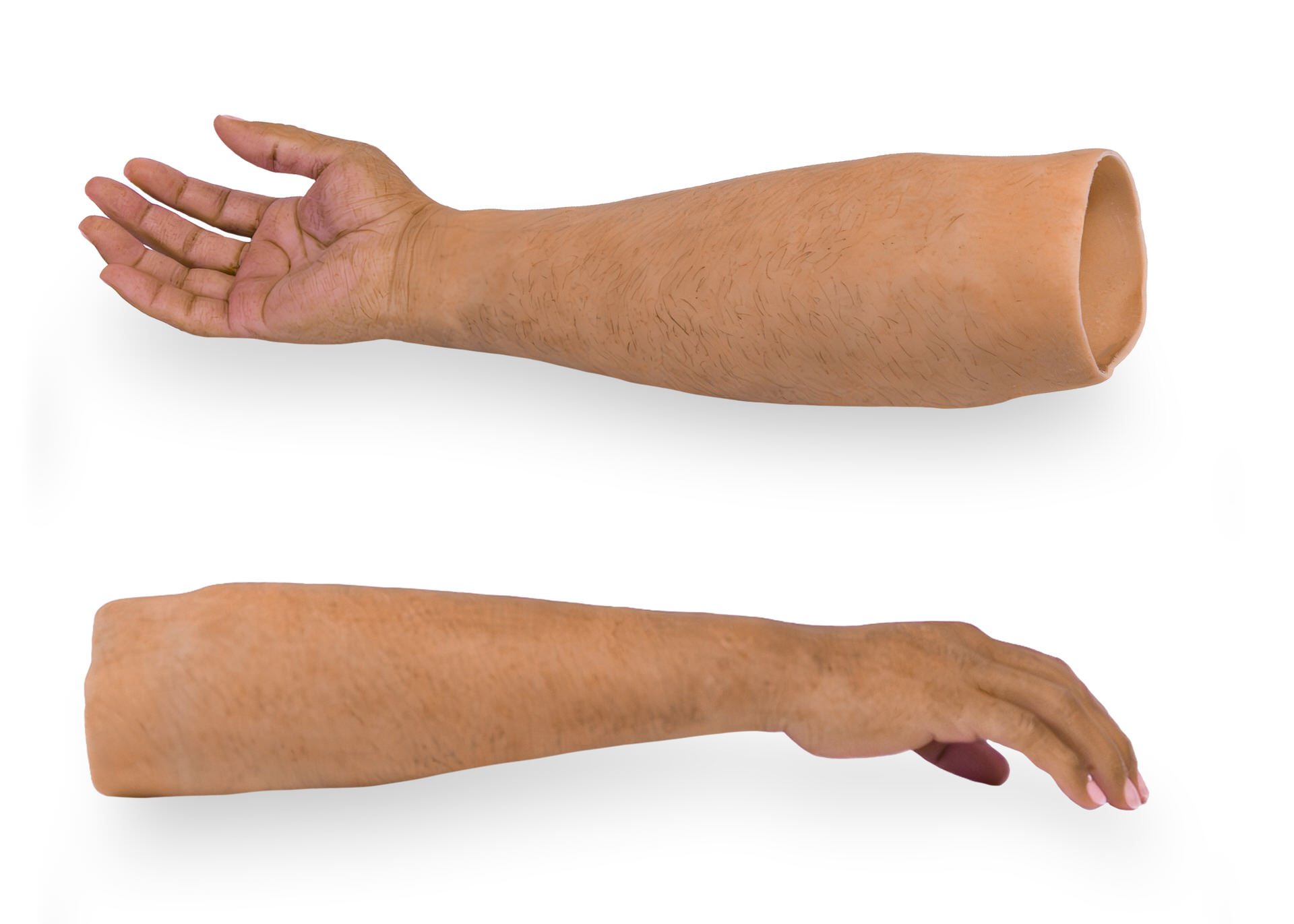 Prosthetic Forearm From DIMA